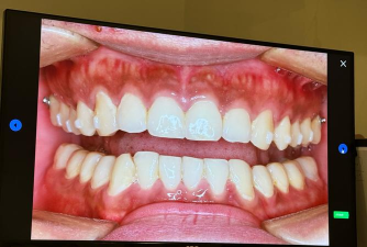 2024年做整容学什么专业好 2024年做整容学什么专业好